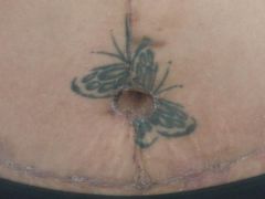 my new belly button (with the remnants of my tummy tatts)