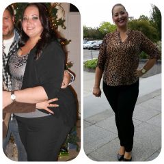 7 months before & after Sleeve Gastrectomy 