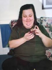 My Bariatric Life before weight loss and plastic surgeries