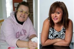 My Bariatric Life, Dr. Joseph F. Capella, Dr. Catherine Winslow plastic surgery after weight loss