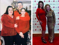 My Bariatric Life Before and After Photo Gallery