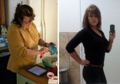 My Bariatric Life before and after tummy tuck after massive weight loss