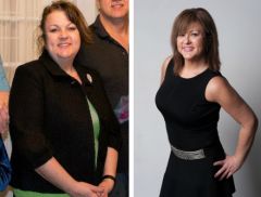 My Bariatric Life, Dr. Joseph F. Capella, Dr. Catherine Winslow plastic surgery after weight loss