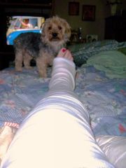 Brody is so worried about my leg.