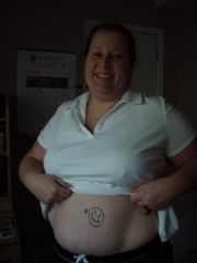 smiley I put on my belly b4 surgery