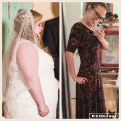173 lbs lost (since surgery)