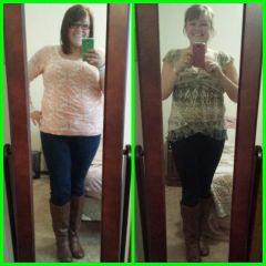 weight loss journey; AFTER surgery