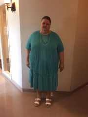 Before Surgery, August 2015, 403 pounds