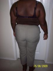 Pre-op weight 248.9 size 16 back view