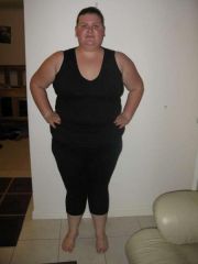 13 May 2009 - 5 days post op 
(according to my dodgy scales - 4kgs down!)