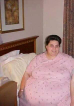 Angie Coon  Pre-Op 500 lbs..png