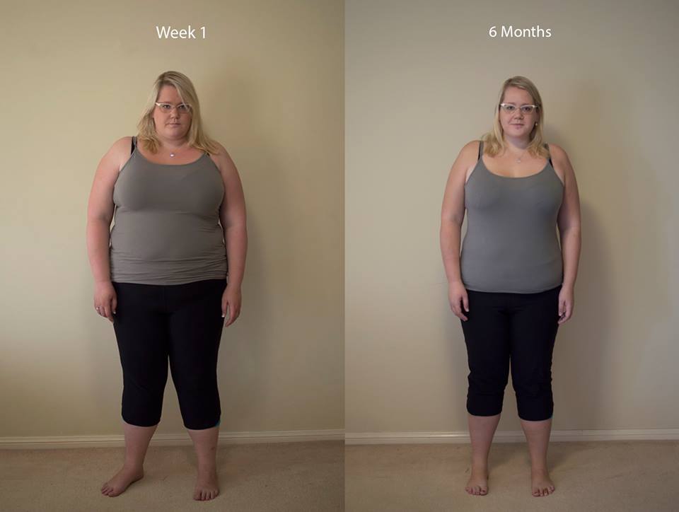 6 Months Before And After Gastric Sleeve Photos Bariatricpal 6610