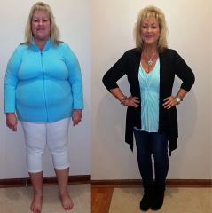 Down 105 lbs - 9 months post-op!
