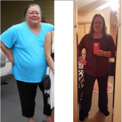 My Before and After:  May 2014/October 2015
