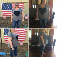 1 month post RNY Gastric Bypass (before and after)