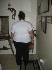 06-19-09 Right after having surgery. 268.5 lbs