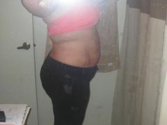 07-17-09 4 wks post op!!!