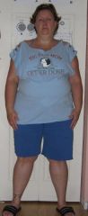 This pic 2 weeks before follow up appt. to get surgery date.
Taken June 28, 2009