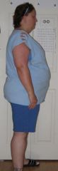 This pic 2 weeks before follow up appt. to get surgery date.
Taken June 28, 2009