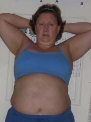 This  pic 2 weeks before follow up appt. to get surgery date.  Taken June 28, 2009