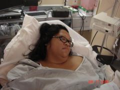 SURGERY DAY - 6/17/09