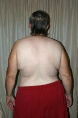 10th month back view 258 pounds