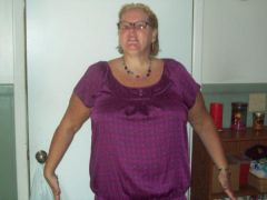 fat me at 257.6 lbs i have been approved for surgery