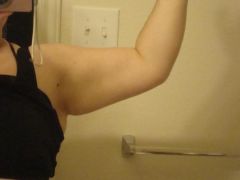 Seeing some change in my arms. 1/25/10