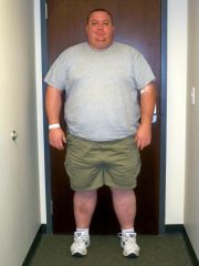 My first visit to my Doc the end of July 2009. 450lbs