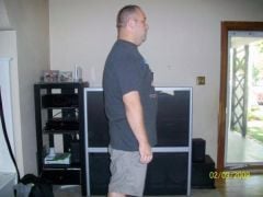 6 week post op side
298 lbs here first time under 300 in 13 years