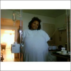 5-14-09 a few hours after surgery