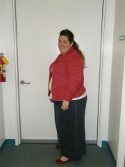 This was taken the day i started my pre-op diet. I weighed 308. wowzers!