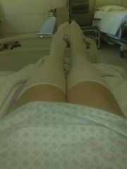 The drop dead sexy knee high anti-thrombosis socks in the hospital.