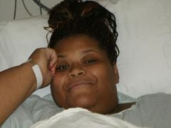 Before surgery Oct 9