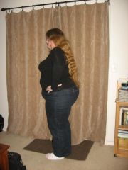 ~Pre-Op (Night Before)
~December 2009
~Roughly 303 pounds