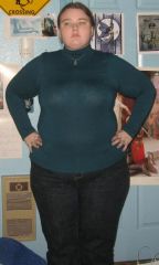 ~Post-Op
~December 2009
~Roughly 290 pounds

~Ten days after my operation.

I never look happy in these pictures.