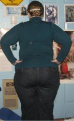 ~Post-Op
~December 2009
~Roughly 290 pounds

~Ten days after my operation.