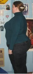 ~Post-Op
~December 2009
~Roughly 290 pounds

~Ten days after my operation.