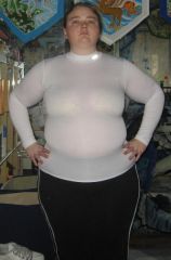 ~Post-Op (1 Month)
~January 2010
~Roughly 288 pounds

Pardon the bra. This is my undershirt for working out.