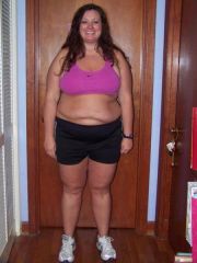 Bretteni 5 month post op front.  34 lbs lost and 22 inches lost