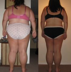 A view from behind - November 2010 - 107 lbs Down