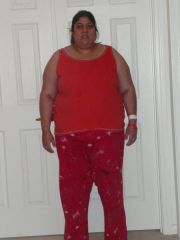 Me At 304 Lbs !!! Day after Surgery !!!