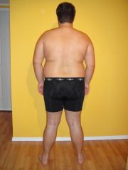1 week pre op (back) - 285 pounds