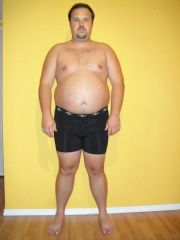 1 week pre op (front) - 285 pounds