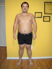 1 month post op (29 pound weigt loss - 256 pounds)(front)
