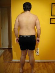 3 months post op (48 pound weigt loss - 237 pounds)(back)