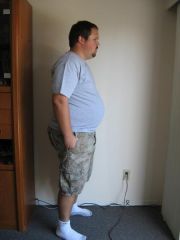 5 weeks pre-op (285 pounds)