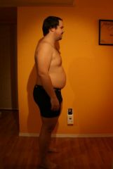 2 months post op (40 weight loss - 245 pounds