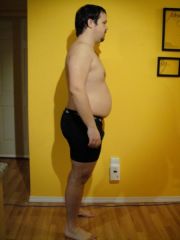 3 months post op (47 # weight loss - 238 pounds