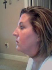 Ugh that nasty double chin is still there....but now it is double instead of triple 11-23-08 Down 37 lbs